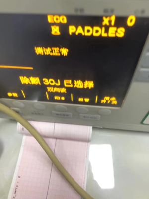 ZOLL M सीरीज डिफिब्रिलेटर मशीन पार्ट्स संकाय मरम्मत सेवा खुदरा